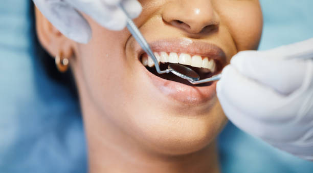 Best Emergency Denture Repair in Miami Lakes, FL